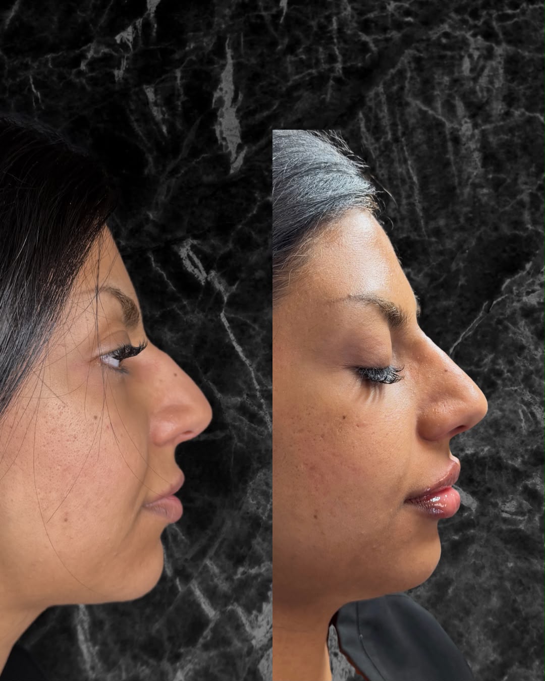 Client side profile assessment for injectable treatment planning